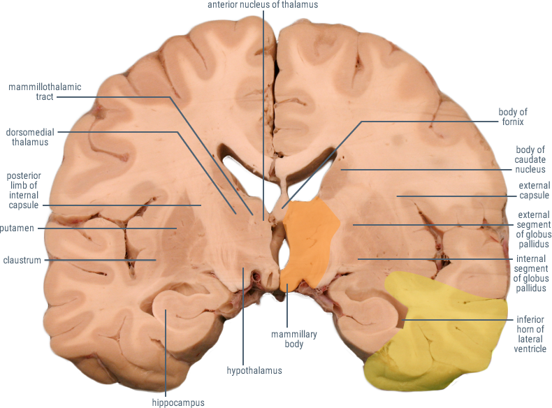 posterior cerebral artery distribution