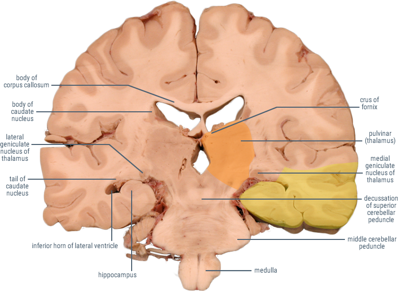 medial geniculate nucleus coronal